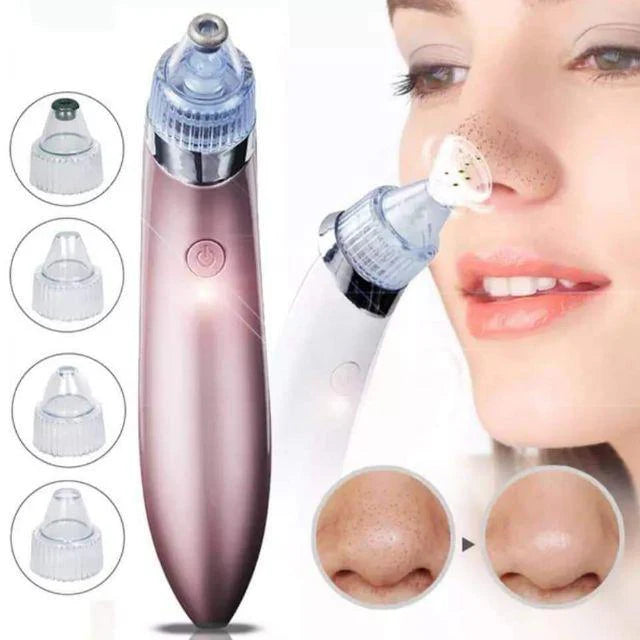 Blackhead Remover Vacuum - Deep Pore & Acne Cleaner Pakistan